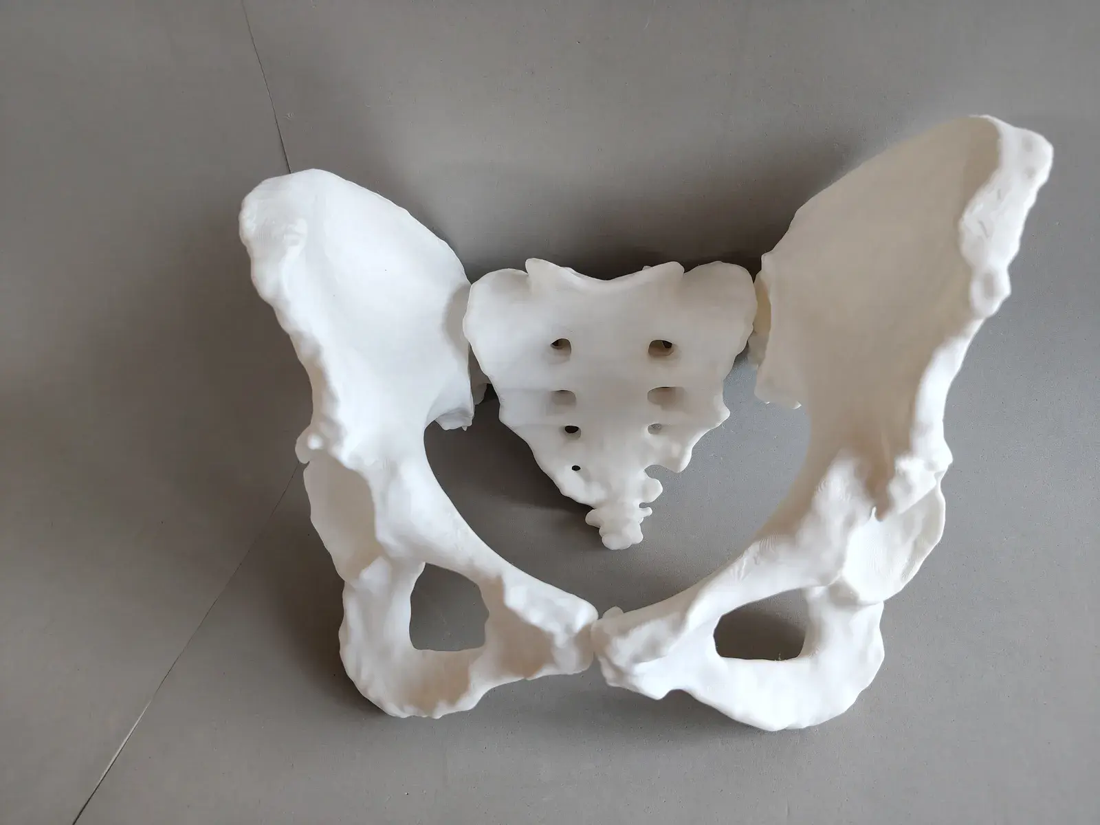 U productos basicos pelvis osea 2